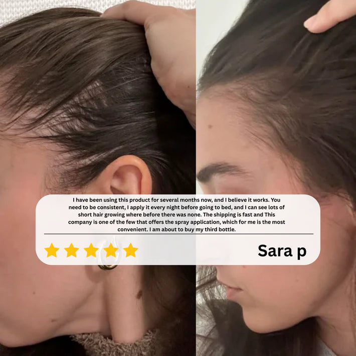 NORELIA APARTHY - Advanced hair growth roll-on serum